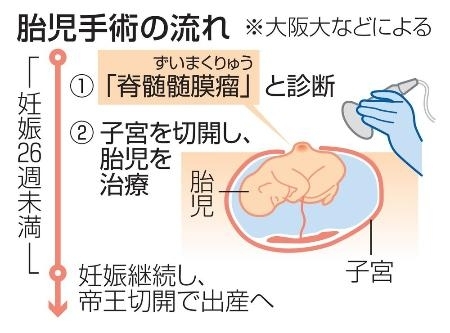 CNTS2024041500699_M.jpg