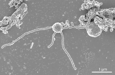 科学スコープ】細菌の名前どう付ける？ 培養かゲノムか、二つの命名法